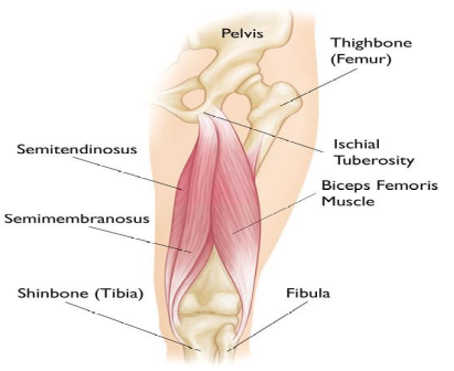 IONA Physiotherapy - WHAT AND WHERE IS THE ILIOTIBIAL BAND (ITB